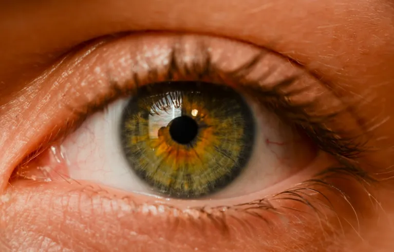 Iris
