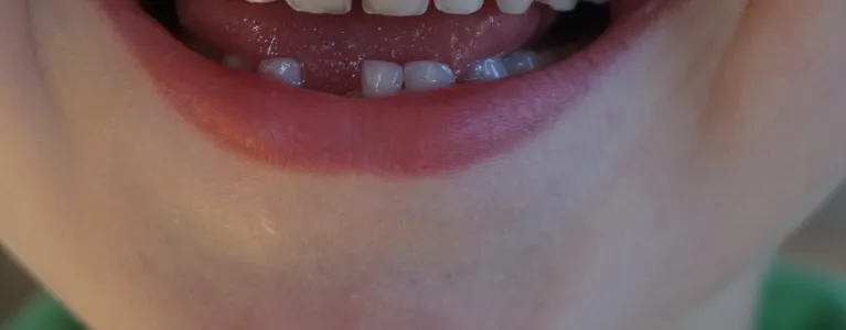Child's teeth