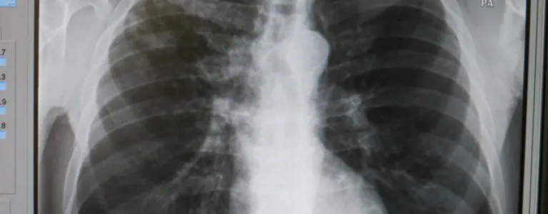 x-ray