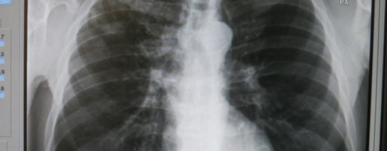 x-ray