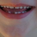 Child's teeth
