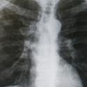 x-ray